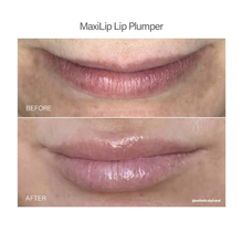 Load image into Gallery viewer, MaxiLip Lip Plumper before and after treatment